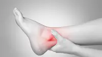 8 Cara Mengatasi Kaki Terkilir, Bisa Dilakukan Sendiri di Rumah