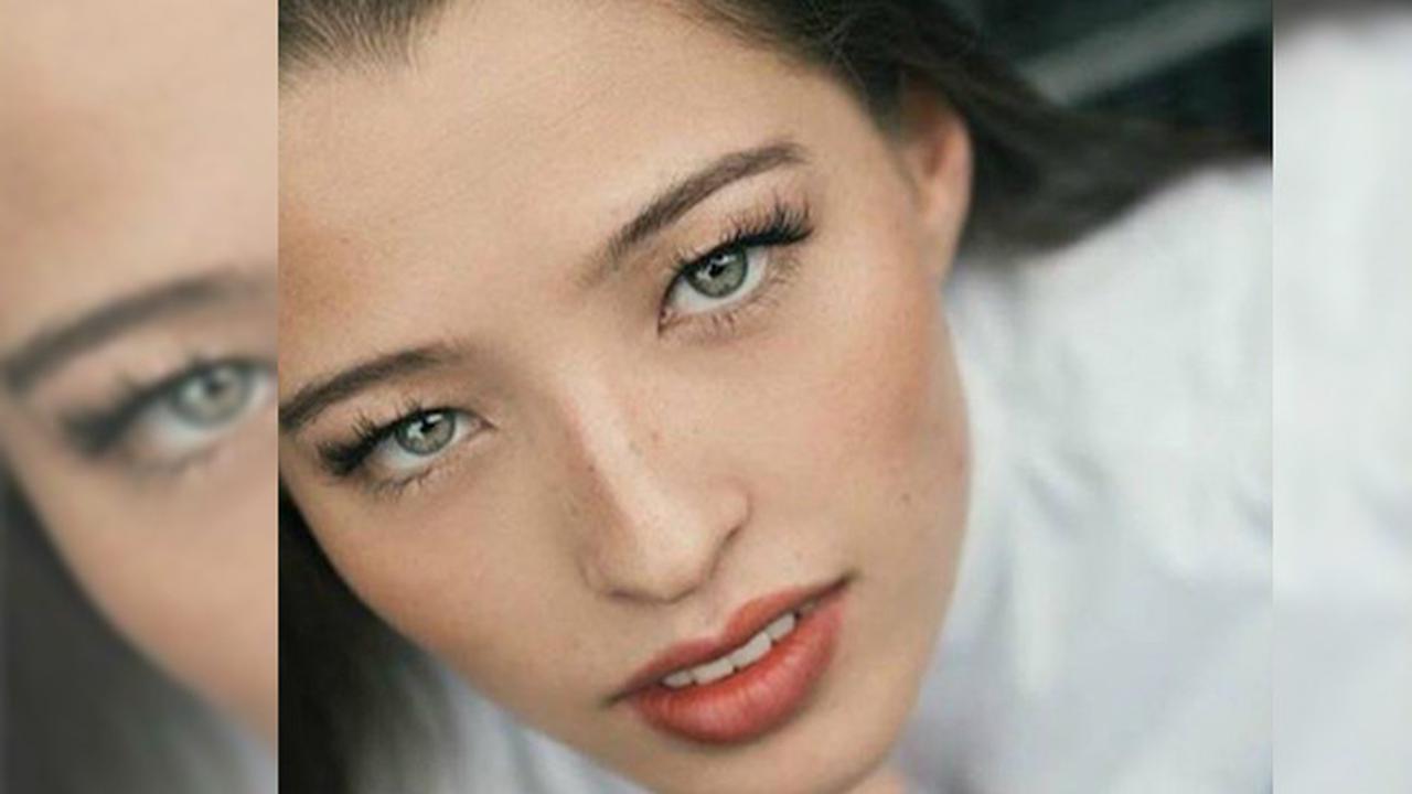 Tragis, Wajah Wanita Cantik Ini Rusak Terkena Pengharum Ruangan