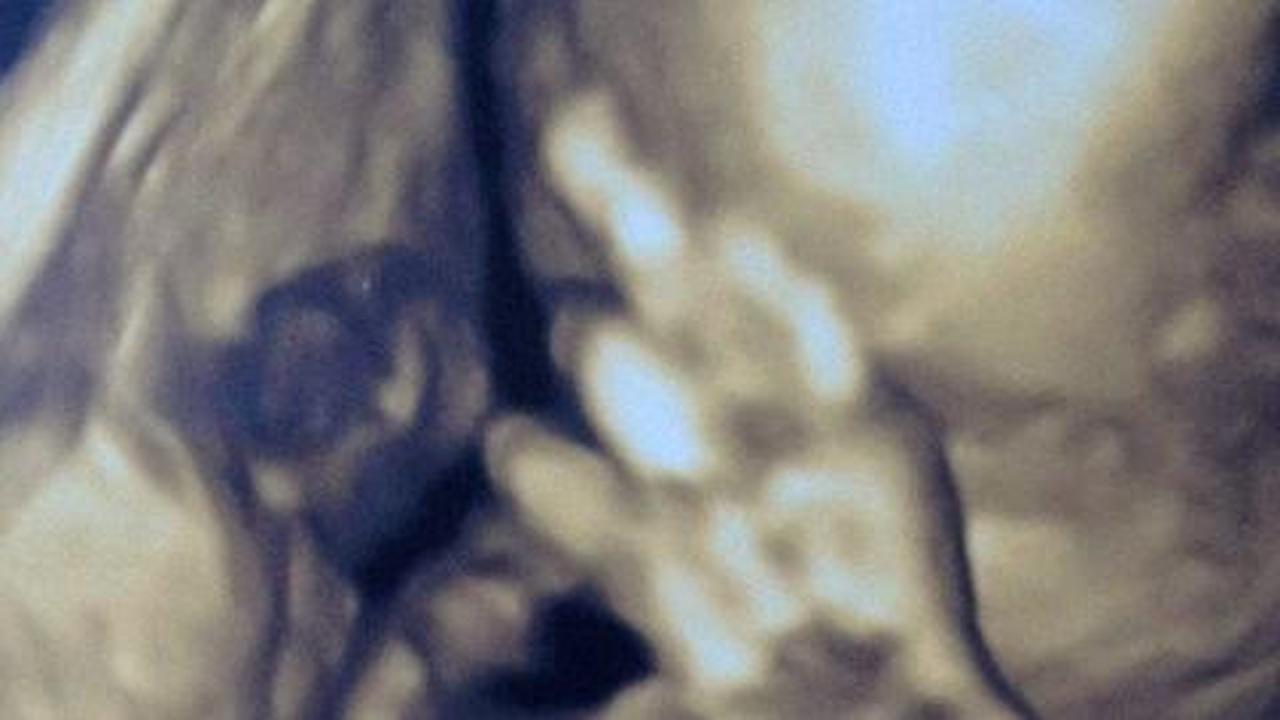 Foto bayi dalam kandungan acungkan jari tengah