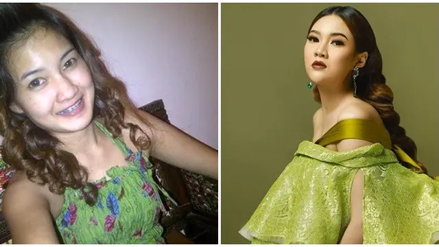 Beda Penampilan 10 Pedangdut Wanita di Awal Karier dan Kini, Jadi Sorotan