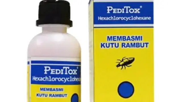 Ilustrasi obat kutu rambut (Foto: Halodoc)
