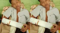 Bukan Perundungan, Ini Penyebab 2 Siswa SMP Berkelahi hingga Patah Tangan