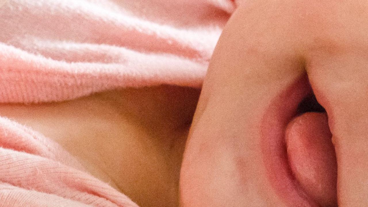 Keterlambatan pertumbuhan gigi pada bayi bisa menjadi sumber kekhawatiran bagi orangtua. Proses tumbuh gigi pada bayi umumnya dimulai sekitar usia enam bulan, tetapi setiap anak bisa berbeda-beda. Beberapa bayi mungkin mengalami keterlambatan dalam tumbuh