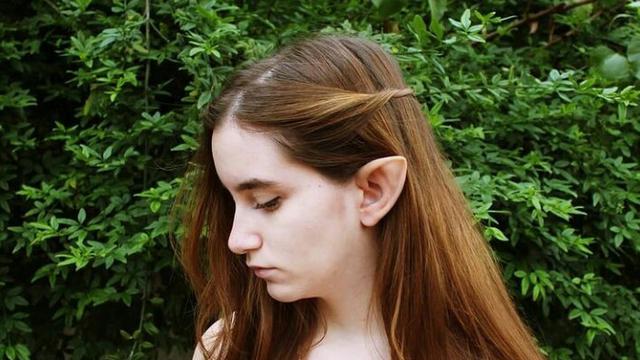 Telinga Peri, Tren Operasi Plastik yang Digemari Anak Muda China agar Wajah Tampak Ramping