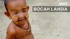 Seorang bocah yang baru berusia 4 tahun mengalami penyakit aneh. Wajah dan kulit di tubuhnya mengendur sehingga tampak seperti kakek-kakek