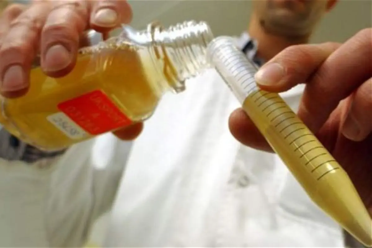 Warna urine