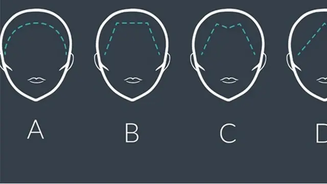Menebak Kepribadian dari Garis Batas Rambut, Kamu yang Mana?