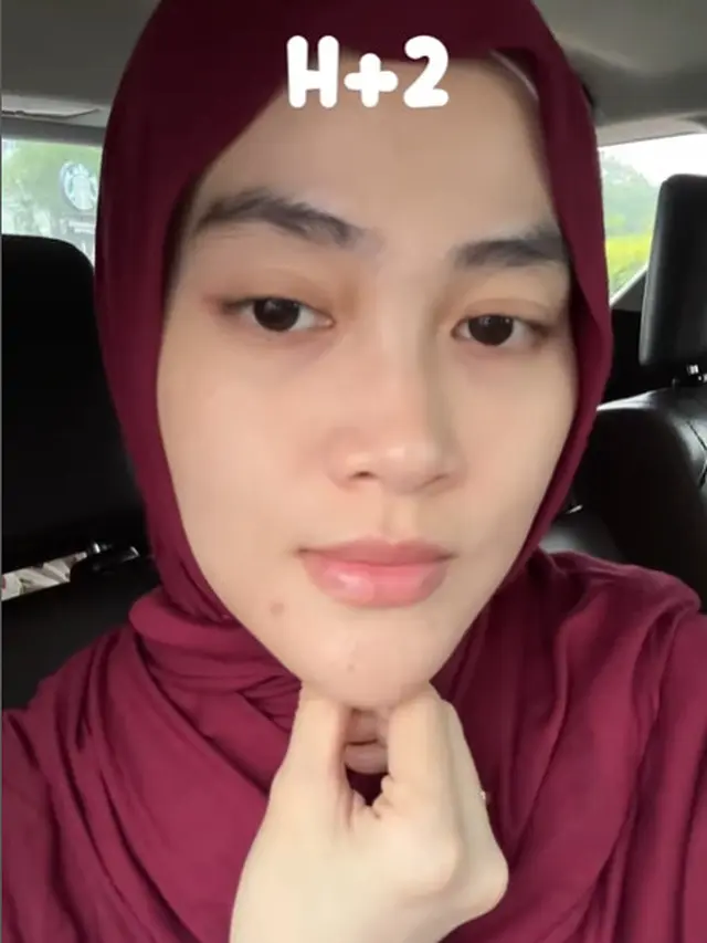 6 Potret Perubahan Wajah Henny Rahman Setelah Perawatan, Makin Cerah dan Mulus