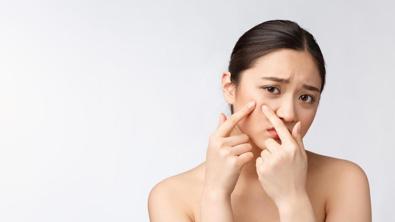 How to Remove Whiteheads at Home