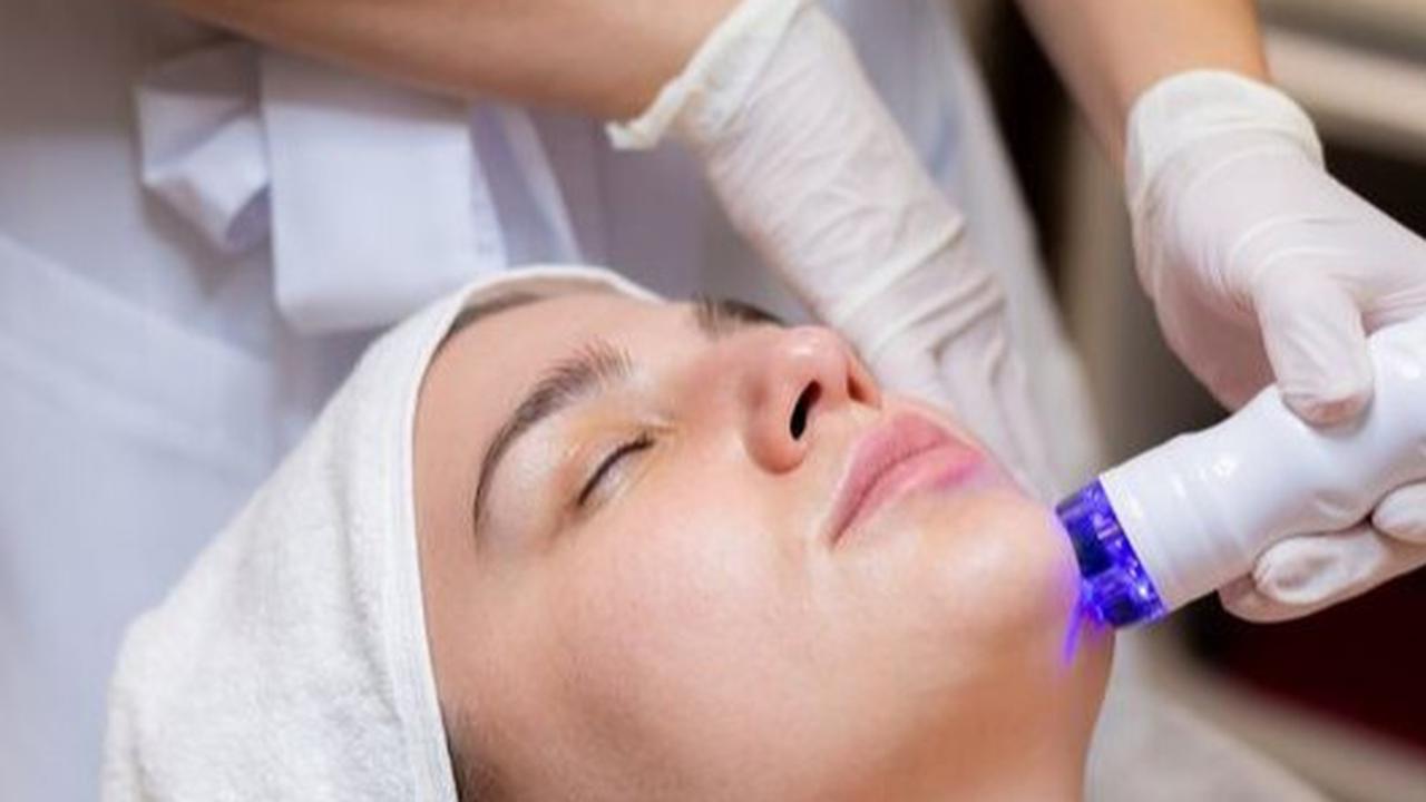 9 Cara Sederhana Menghilangkan Bekas Jerawat Membandel, Wajah Mulus Seketika