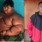 6 Potret Transformasi Arya Permana Bocah Berbobot Nyaris 200 Kg, Bikin Takjub (Sumber: Instagram/dedimulyadi71)