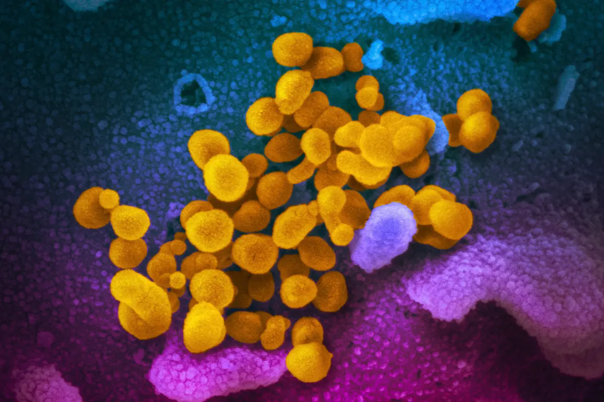 Virus Corona COVID-19 dari Mikroskop