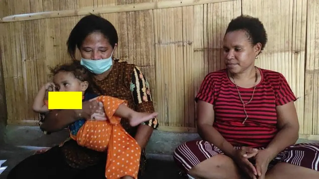 Kristina Yunita 2 Tahun boca yang menderita lida panjang 8,5 Sentimeter di pangku kelurganya dan didampingi ibu kandungnya. (Liputan6.com/ Dionisius Wilibardus)