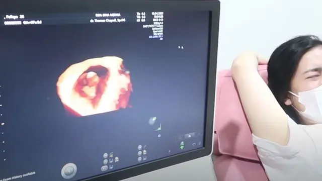 7 Momen Felicya Angelista Periksa Kandungan, Menangis Dengar Detak Jantung Si Kecil