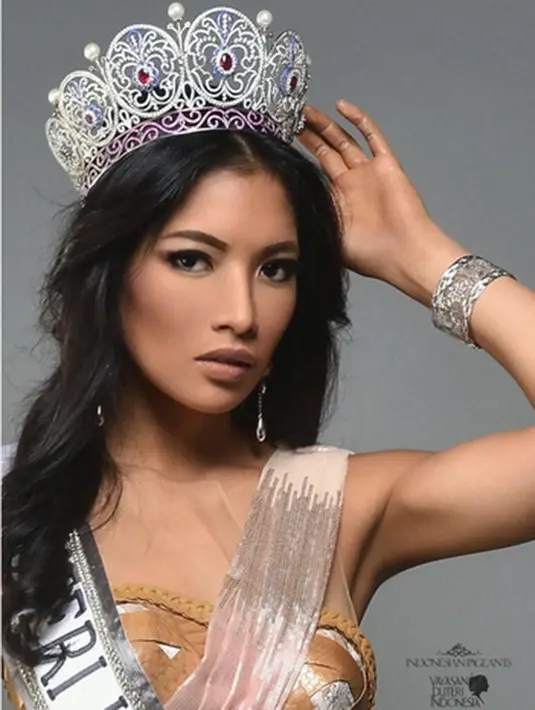 Pose bikini Anin itu justru mendapat banyak pujian dari followers-nya atas keindahan tubuhnya. (Via Instagram/@anindyakputri)