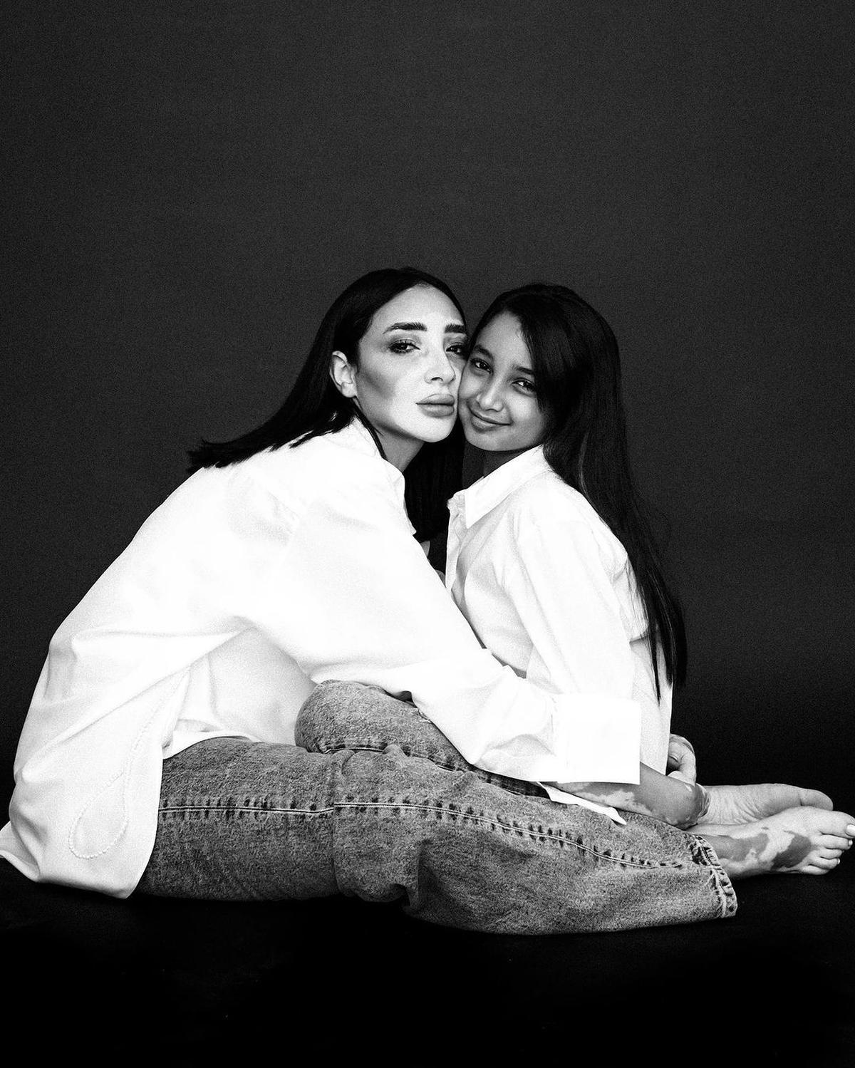Potret Cantik Logina Salah, Miss Universe Mesir Pertama dengan Vitiligo dan Status Ibu