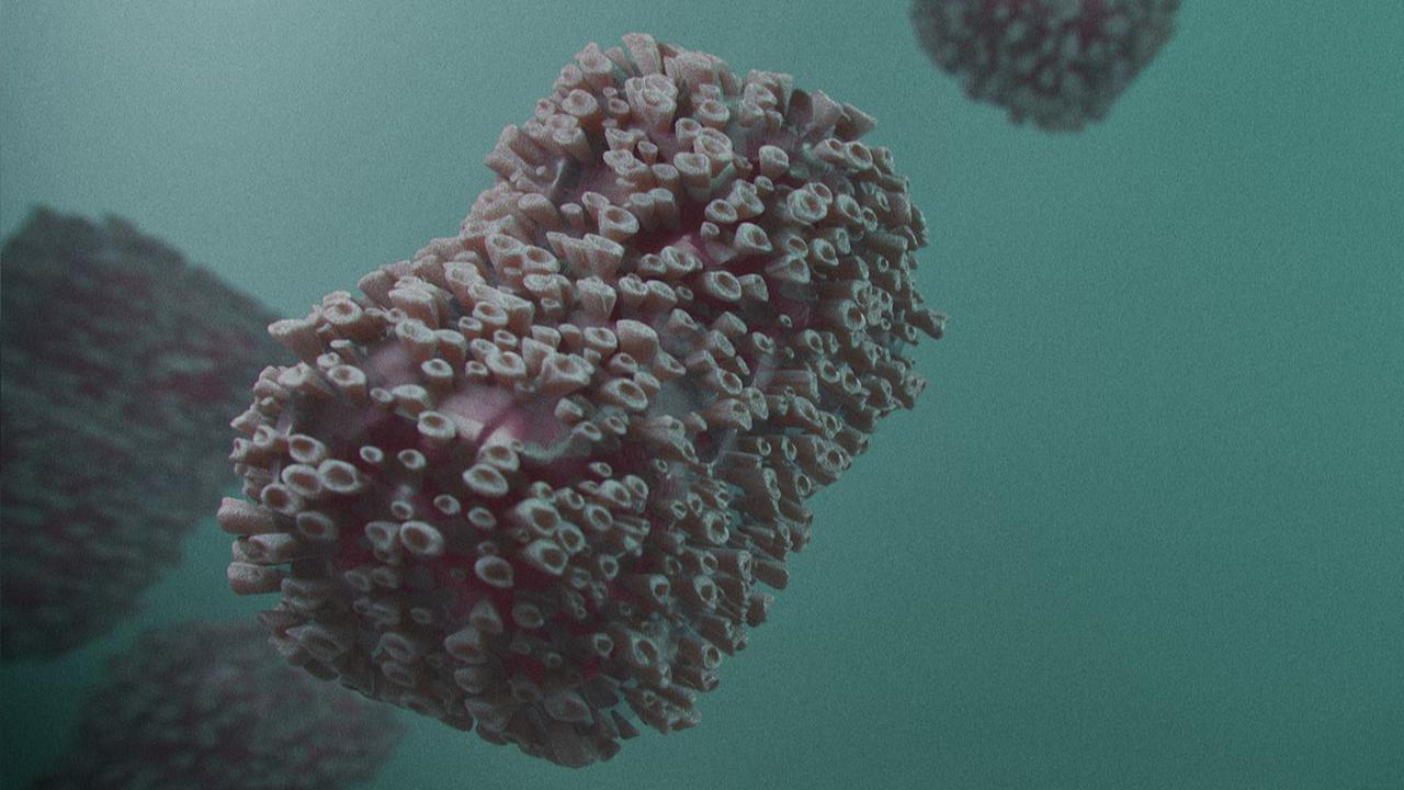 Perbedaan Gejala Mpox dan Cacar Air, Ada Pembengkakan Kelenjar Getah Bening