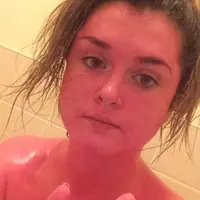 Duh! Niat biar badan bersih, perempuan ini malah mengalami perubahan warna jadi pink. (Via: dailymail.co.uk)