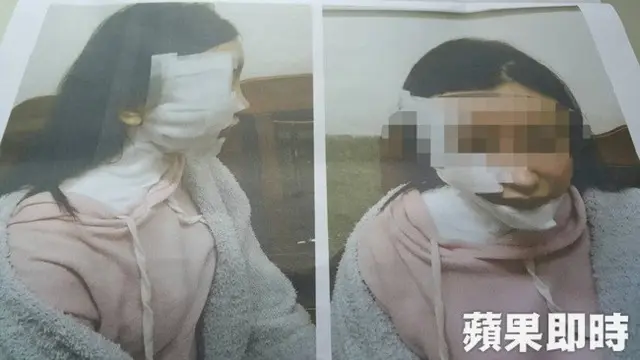 Tak Sengaja Sentuh Tangan, Pria Tega Siram Wajah Wanita dengan Sup Panas