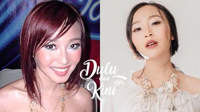 Dulu dan Kini: Transformasi Rinni Wulandari yang Menakjubkan