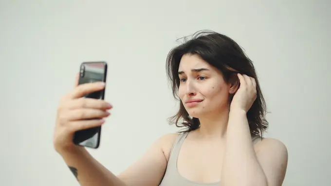 Jerawat wajah bisa ungkap kesehatanmu (dok. Polina Tankilevitch/Pexels.com)