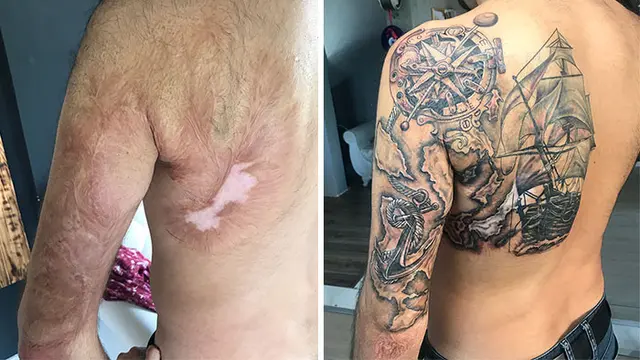 tato dari bekas luka (foto: boredpanda)