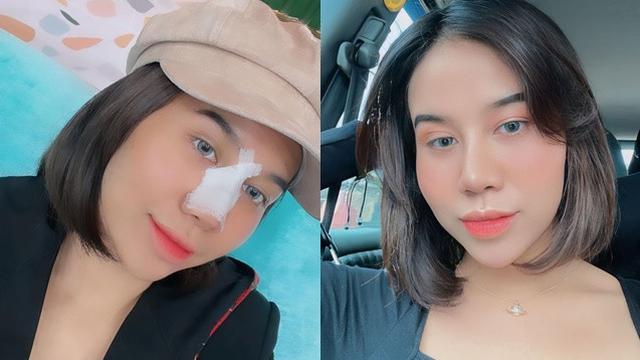 6 Potret Seleb Jalani Operasi Plastik di Tahun 2022, Penampilannya Bikin Pangling (sumber: Instagram/)