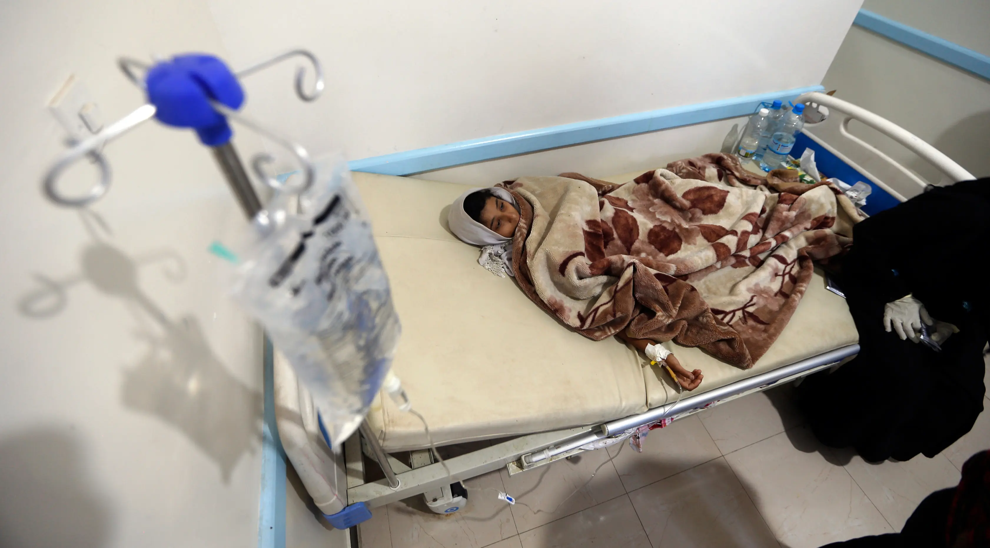 Seorang anak yang diduga terinfeksi kolera dirawat di sebuah rumah sakit di Sanaa, Yaman (15/5). Kolera adalah infeksi bakteri pada usus halus yang bisa menyebabkan diare parah dan dehidrasi serta dapat menyebabkan kematian. (AFP Photo/Mohammed Huwais)