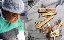 Kecanduan Media Sosial, Pria ini Sengaja Menelan Kunci dan Pemotong Kuku Bikin Ibunya Syok