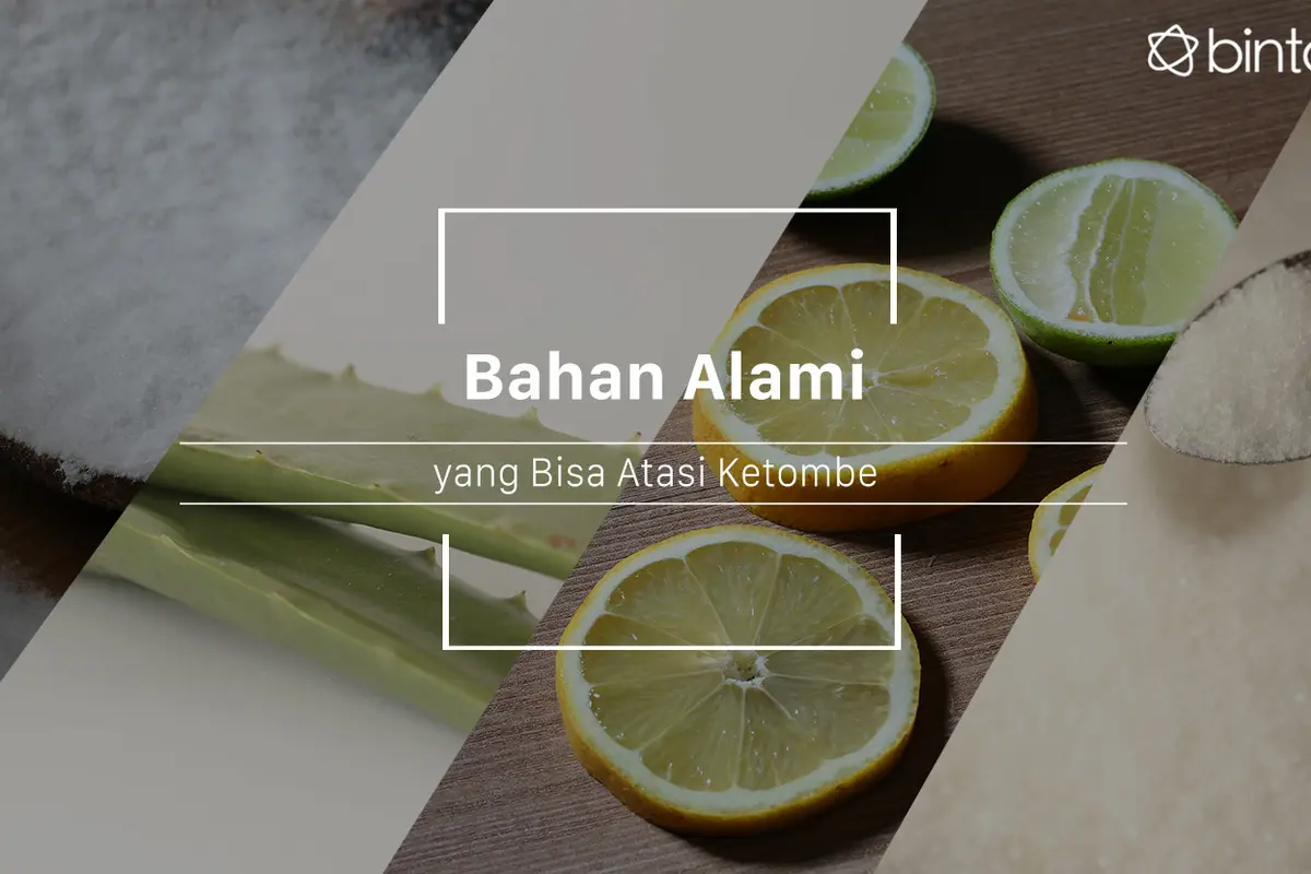 Atasi Ketombe dengan 5 Cara Ini, Dijamin Hilang!