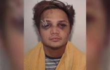 Duduk Perkara Predator Seks Asal Indonesia Reynhard Sinaga Diduga Jadi Sasaran Serangan di Penjara Inggris