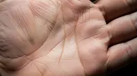 Menguak Arti Garis Tangan Tidak Menyatu Alias Simian Line dalam Ilmu Palmistry