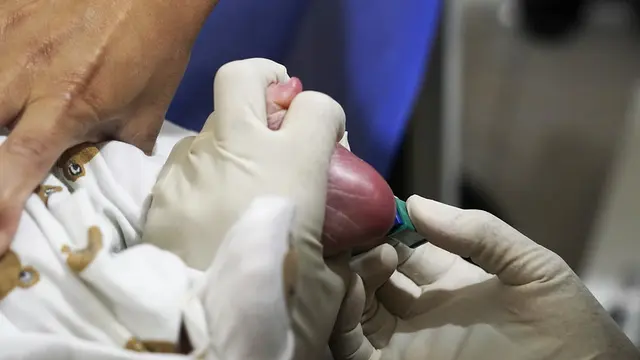 Pemeriksaan Kesehatan Gratis pada Bayi dengan Mengambil Sampel Darah di Telapak Kaki. (Dok Kemenkes)