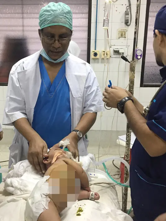 Dokter ahli bedah memeriksa Tofa dan Tahura usai menjalani operasi di Rumah Sakit Medis Dhaka di Dhaka, Bangladesh (2/8). Tofa dan Tahura mengalami pedempetan pada tulang belakang yang diharuskan menjalani operasi. (AFP Photo/ Abdul Hanif Tablu)
