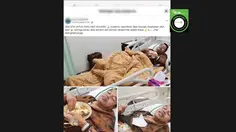 Cek Fakta: Tidak Benar Foto Dedi Mulyadi Sakit pada Juni 2026