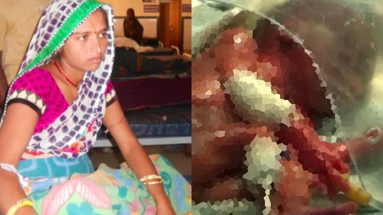 Mati Suri, Bayi Prematur Hidup Kembali Sesaat Sebelum Dikremasi