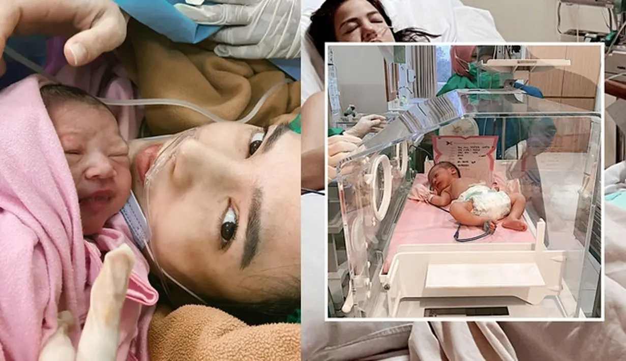 Pendarahan 3 Liter, Ini 6 Potret Perjuangan Alice Norin Melahirkan Anak Kedua (sumber: Instagram.com/alicenorin)