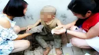 Bocah Malang Ditemukan Hidup di Kandang Babi