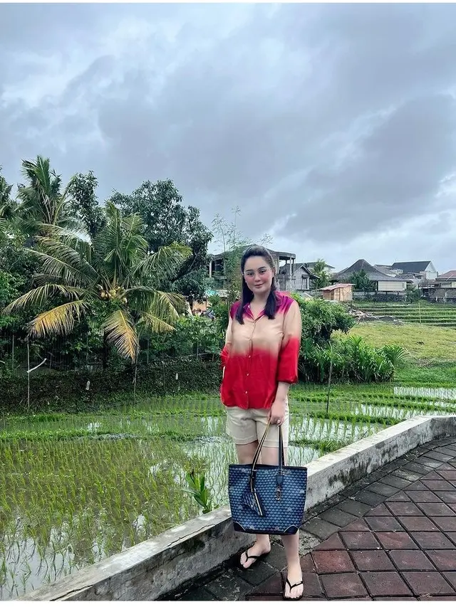 Potret Jennifer Dunn usai jalani Operasi Bariatrik (Foto: jennifer_haris89)
