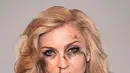 Penyanyi Madonna ditampilkan dengan wajah lebam seperti habis dipukul. Foto yang diedit itu pun diberi tulisan yang memotivasi wanita untuk melawan tindak kekerasan. (dailymail.co.uk)