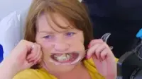 Wanita ini mengalami dentophobia. Hal ini membuatnya mengelem giginya yang tanggal dengan lem super kuat