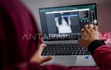 Kementerian Kesehatan Tingkatkan Anggaran untuk Percepatan Deteksi TBC di 2026