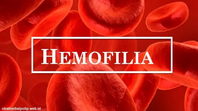 Mengenal Hemofilia, Jenis, Gejala hingga Pengobatannya