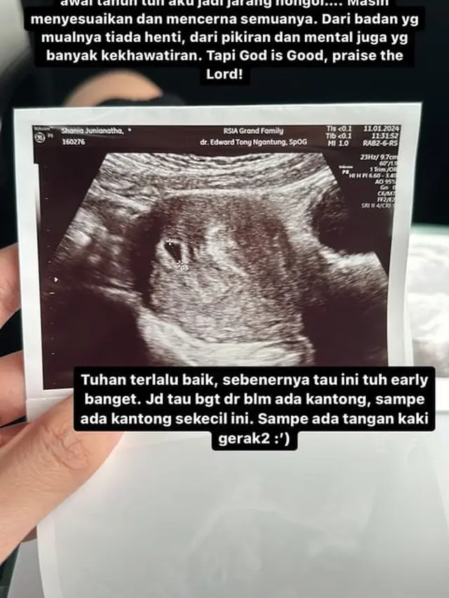 7 Potret Jonatan Christie dan Shanju Umumkan Hamil Anak Pertama, Penuh Kebahagiaan
