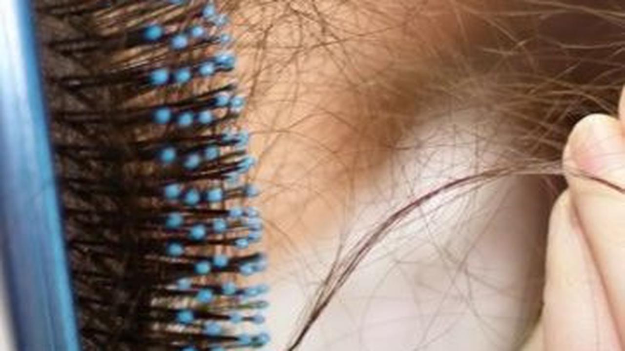 Rambut Rontok Normal dan Tidak Normal