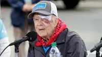 Mantan Presiden AS, Jimmy Carter menghadiri acara yang digelar Habitat for Humanity di Nashville, Tennessee, Senin (7/10/2019). Tampil di depan publik, mata kiri Carter memar dan mendapat beberapa jahitan di alis bagian atas setelah terjatuh di rumahnya pada Minggu waktu setempat. (AP/Mark Humphrey)