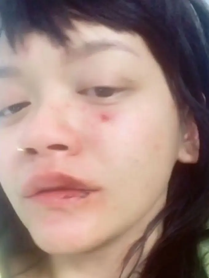 [Bintang] Ini Sosok Pria yang Diduga Telah Bikin Dylan Sada Babak Belur