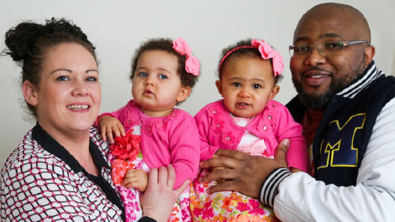 Dua Bayi Ini Kembar Identik dengan Rupa Berbeda