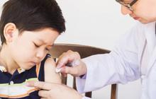 Jadi Wilayah Penyebaran Nyamuk Culex, Ini Kata Guru Besar UGM Terkait Bahaya Virus Japanese Encephalitis