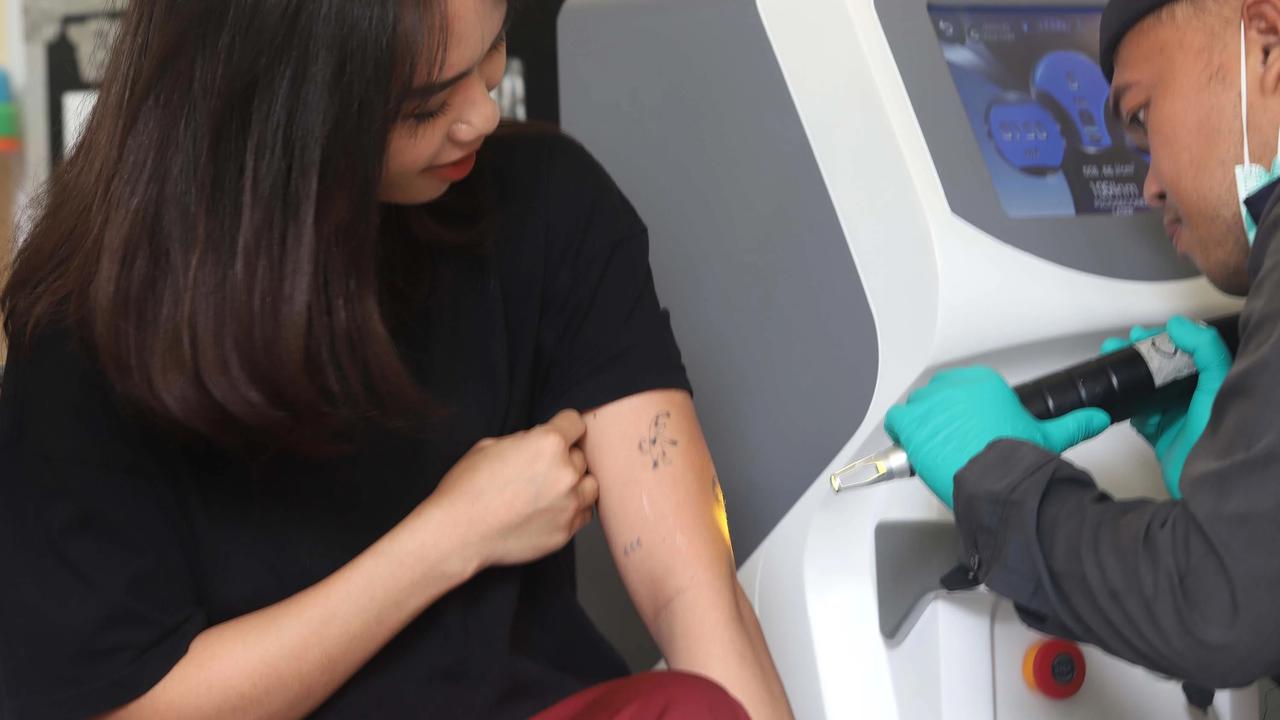 FOTO: Layanan Hapus Tato Gratis Sambut Ramadhan di Jakarta